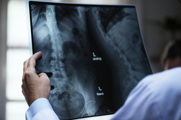 Falmouth Public General Hospital, stock image showing a person holding up an x-ray.